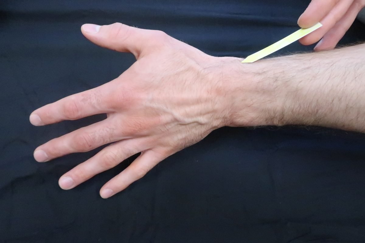 Styloid process of the radius student omt